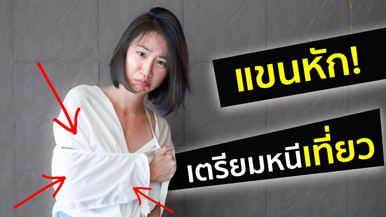 แขนหัก! แต่จะเที่ยว | I Broke My Arm (ENG Sub)