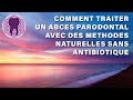 Comment traiter un abcs parodontal avec des mthodes naturelles sans antibiotique