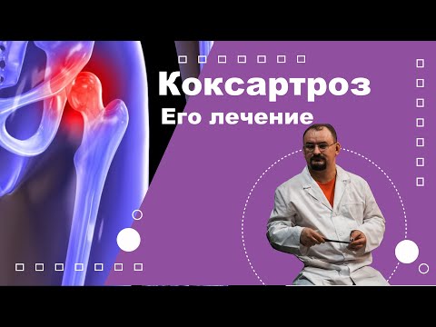 Видео: Коксартроз. Лечение коксартроза.