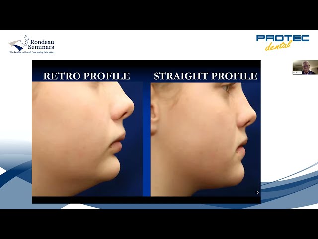 WEBINAR - Early Interceptive Orthodontic Treatmen