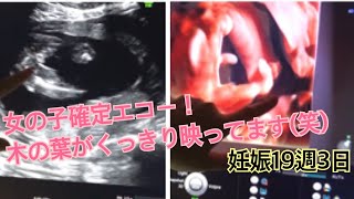 妊娠19週3日 リベンジ版 性別確定 しっかり見えました 4dエコー Youtube