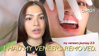 WHAT HAPPENED TO MY OLD VENEERS??  [FULL VENEERS 2.0 EXPERIENCE + FAQs] • Joselle Alandy