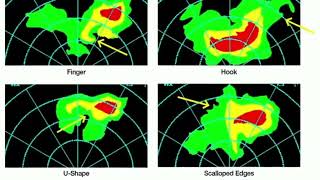 Celebrity Weather Radar: Why Shapes on Radar Matter ?! Profile