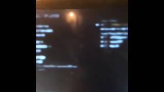 Weird Black Ops 2 Screen Glitch