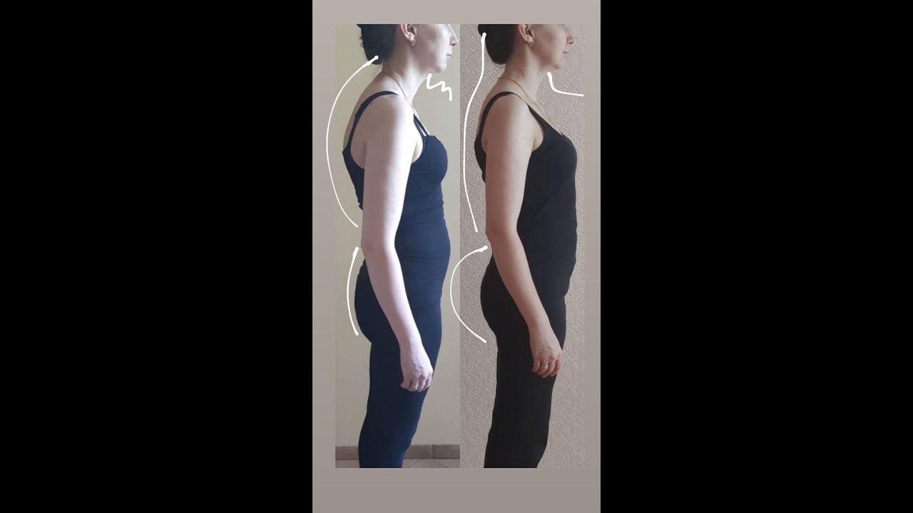 🔥 Как ваша осанка влияет на лицо! Разбор зависимостей анатомии тела и ...