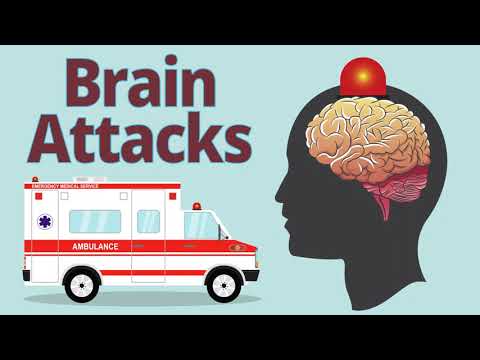 How Stroke Affects the Brain