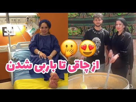 ولاگ اسليو معده بعد ٦ماه چقدر تغيير