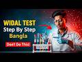 Widal Test Practical Step by Step (Bangla) | How to Do Widal Test in Lab 🧪 | Rasel Ahmed Lab