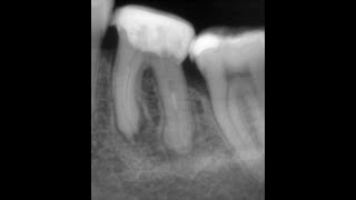 видео: 36 со стекловолокном. До сих пор тестируем оборудование. картинка: 36 со стекловолокном. До сих пор тестируем оборудование.
