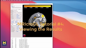 MRIcroGL Tutorial #4: Viewing the Results