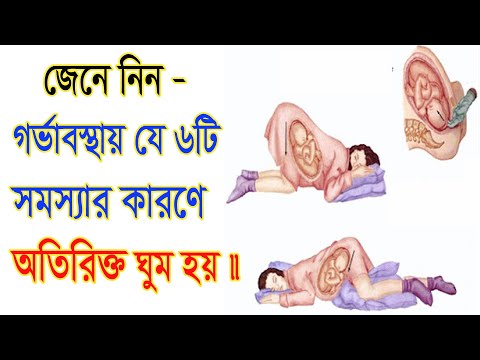 ভিডিও: গর্ভাবস্থায় অতিরিক্ত ঘুমের কারণ কী?