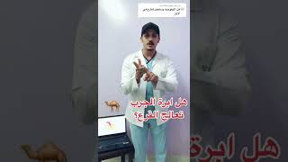 هل ابرة الجرب الايفومك تعالج مرض القرع!!؟