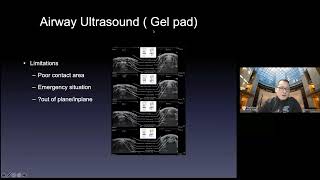 Point of Care Airway Ultrasound. News