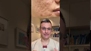 Aknenarben Behandeln - Wann Ist Es Zu Spät?