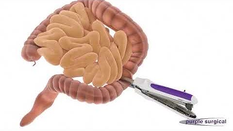 The Ultimate Reloadable Linear Cutter Stapler on Vimeo1