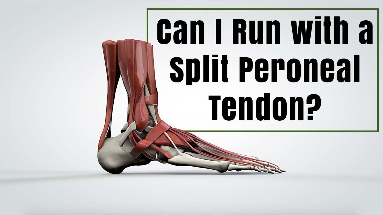 Peroneal Tendon peroneal-tendon