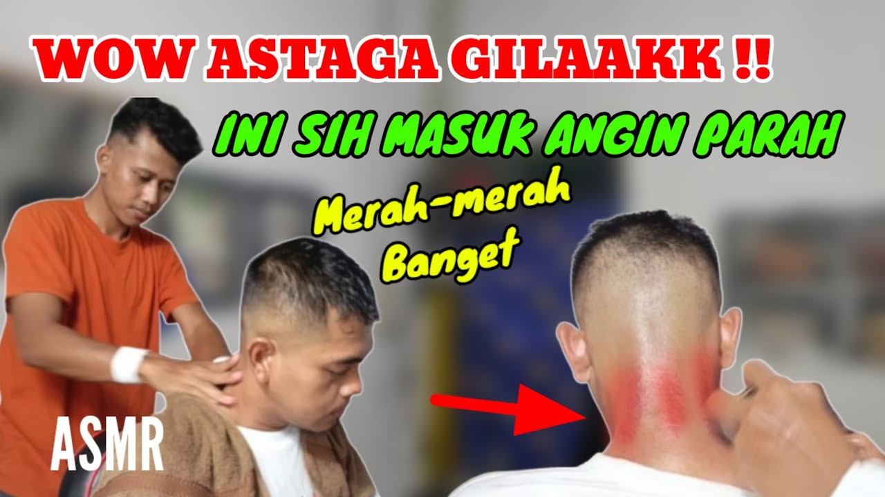 WOW ASTAGAA!! Ini sih masuk angin parah sampe merah-merah banget