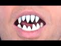 Shark Teeth Grow In Mouth!