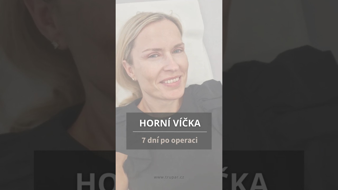 Plastická operace víček - odstranění stehů