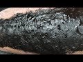 Charcoal mask takes the Flake! [Psoriasis]