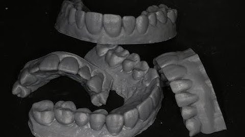 making solid models in meshmixer for DAs by a DA