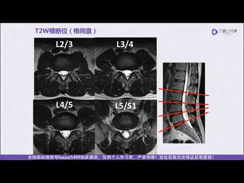 丁香园公开课|脊柱MRI进阶指南| 04  腰椎 MRI 解剖