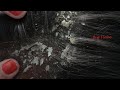 Dandruff Removal