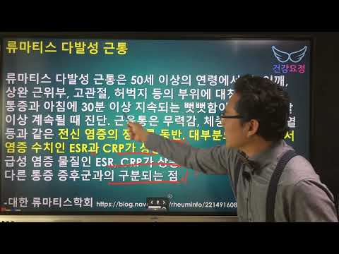 류마티스성 다발성 근통에서 조조강직이 없을 수도 있나요?