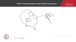 COVID-19 Nasopharyngeal Swab Collection Instructions | BioReference Laboratories