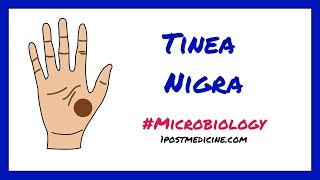 Tinea Nigra Microbiology