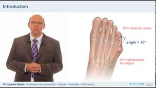 Diagnostic Du Quintus Varus