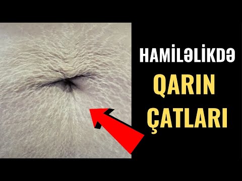 Video: Tampondakı çatlaqları düzəldə bilərsinizmi?