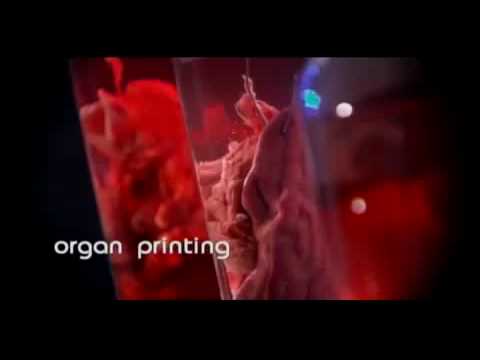 Impresión de órganos