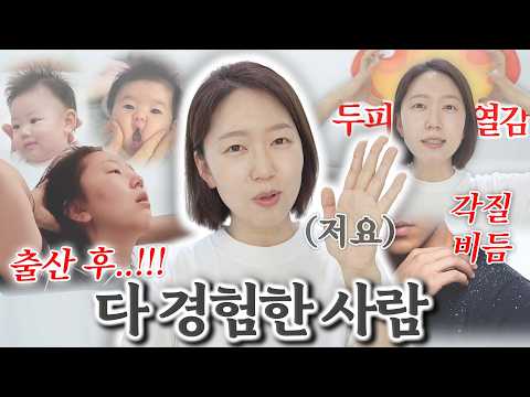 출산 후 <strong>두피</strong>, 열감, 각질/비듬, 두피기름!! 지성!!! 이렇게 해결해보세요. *<strong>두피</strong> 고민 상담소