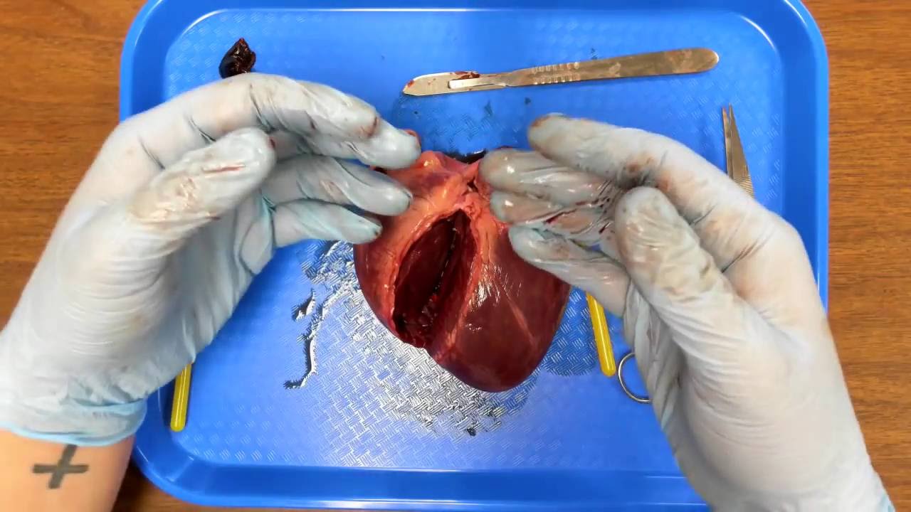 Lab Report Heart Dissection Of The Heart