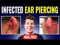 Doctor explains HOW TO RECOGNIZE AND TREAT INFECTED EAR PIERCING