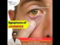 Symptoms Of Jaundice DrAshishSachan