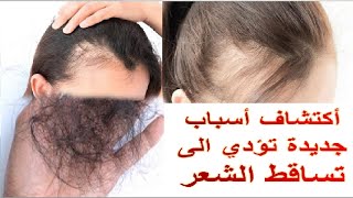 تساقط الشعر وأسباب تساقط الشعر عند النساء والرجال Hair loss and causes of hair loss in women and men