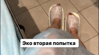 картинка: Выкидыш. Как это было ?