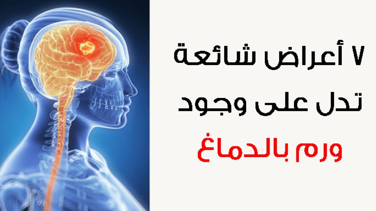 الراس اعراض ورم ما هي