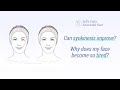 Can synkinesis improve? Why does my face become so tired? - Bell's Palsy Knowledge Base
