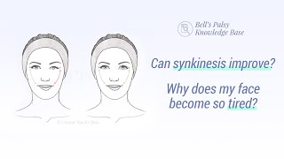 Can synkinesis improve? Why does my face become so tired? - Bell&#39;s Palsy Knowledge Base