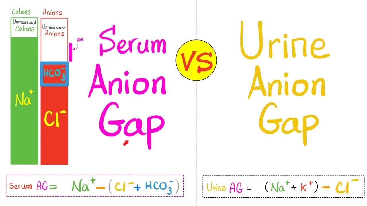 22. Serum Anion Gap (AG) vs Urine Anion Gap (UAG) AcidBase Imbalance