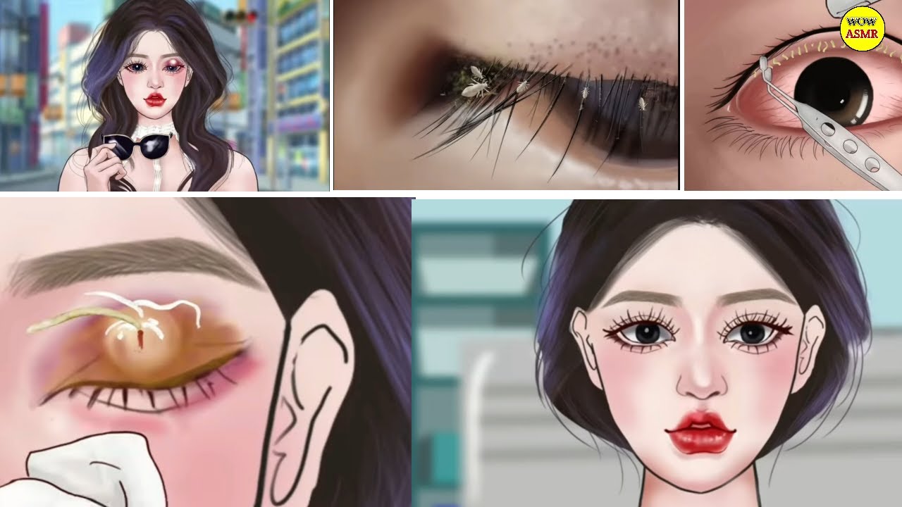 Eye cleaning asmr animation eye satisfying treatment asmr 