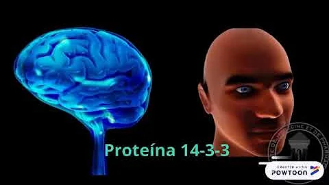 ¿Hacen los priones agujeros en el cerebro?