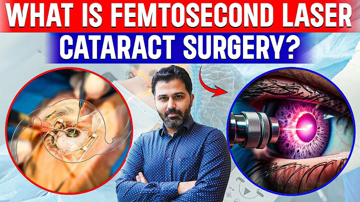 What is Femtosecond Laser Cataract Surgery?