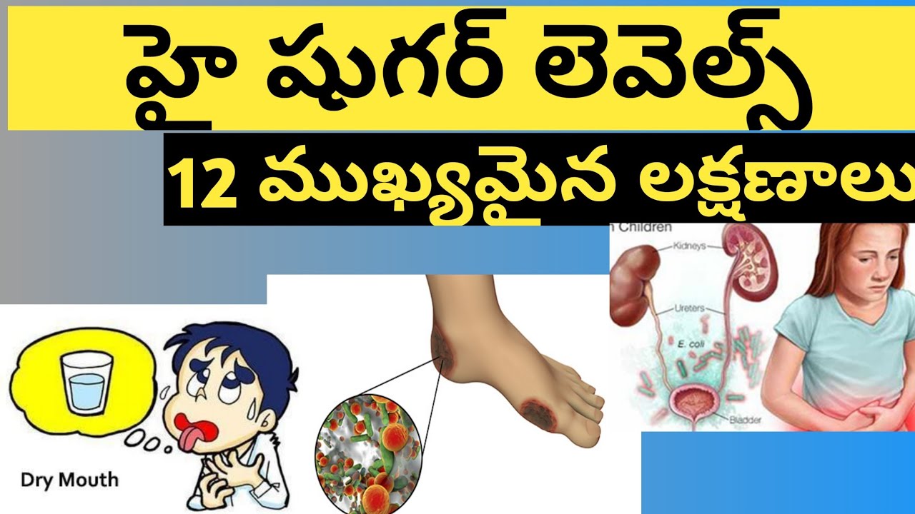 Top 12 Signs that you have High Blood Sugar Levels (Telugu) YouTube