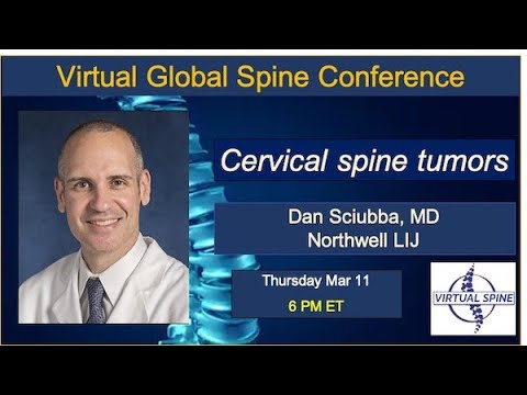 Cervical spine tumors with Dr Dan Sciubba, MD