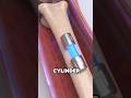 This metal implant could change humanity forever 😱