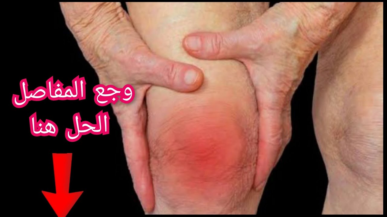 🔴 أقوى علاج طبيعي لآلام المفاصل والركبة في البيت | النتيجة من أول أسبوع